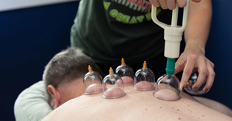 Chiropractic Reading PA Patient Receiving Cupping Session